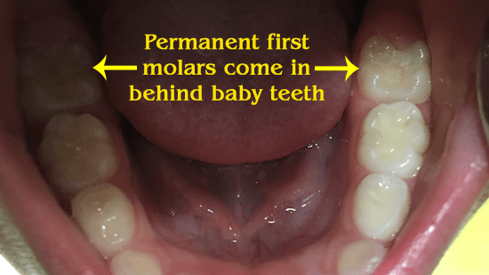 Permanent first molars come in behind baby teeth.