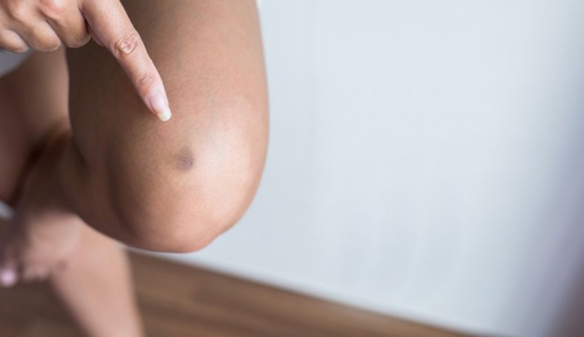A woman is pointing at her knee with a finger.
