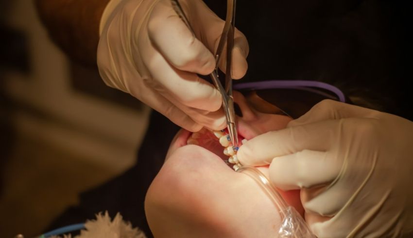 A child's teeth being examined by a dentist.