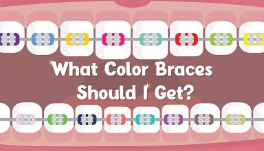 What Color Braces Should I Get