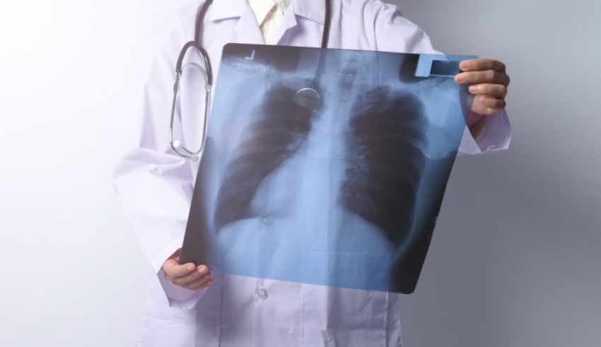 A doctor holding up an x - ray.