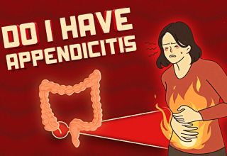appendicitis quiz