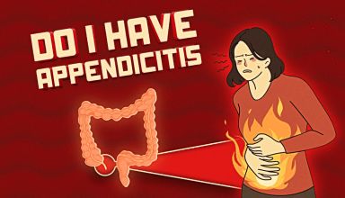 appendicitis quiz